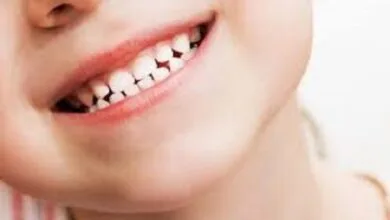 اهمیت تغذیه بر سلامت دندان کودکان؛ والدین پوسیدگی دندان در بچه‌ها را جدی بگیرند